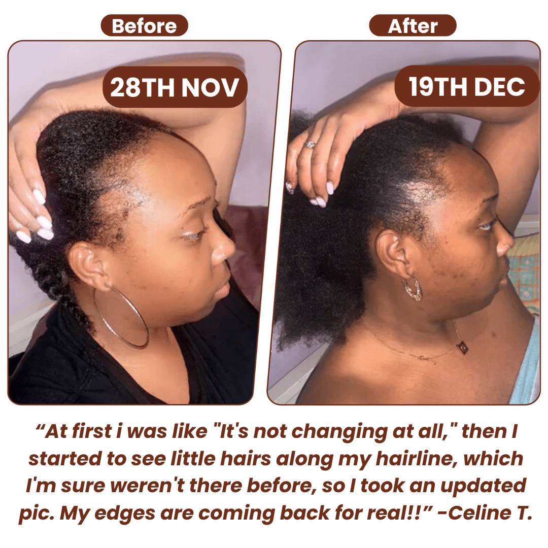 Batana Natural Hair Growth Oil