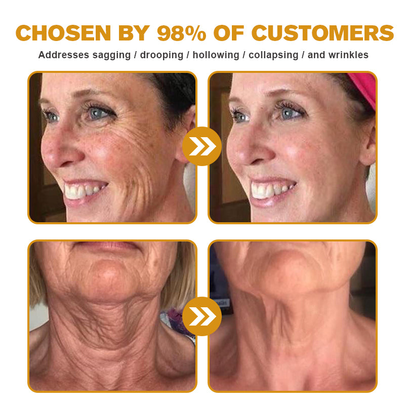 NUUE™ Botox Bienengift-Faltenentfernungscreme – LETZTER TAG 70 % RABATT