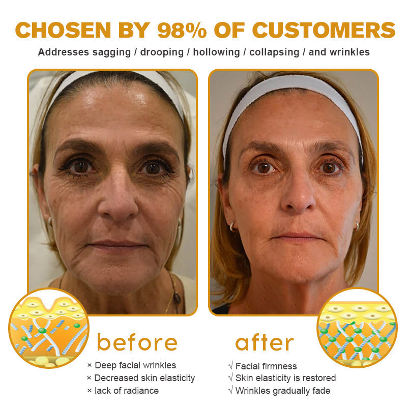 NUUE™ Botox Bienengift-Faltenentfernungscreme – LETZTER TAG 70 % RABATT