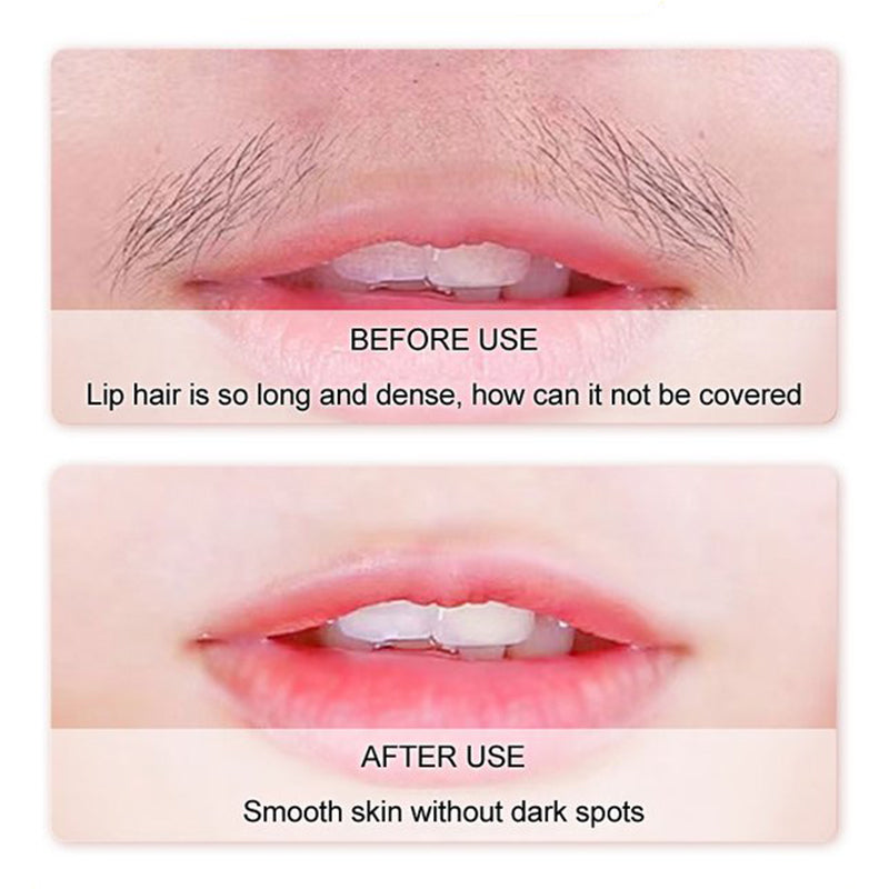 Hoygi™  - Gentle and Painless Facial Hair Removal Cream