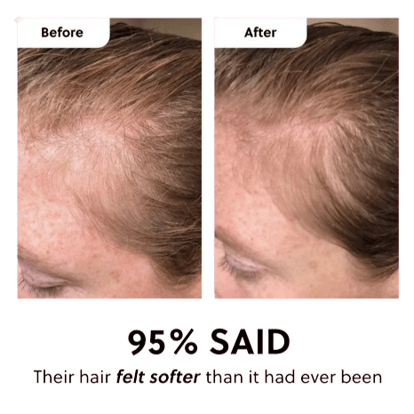 Batana Natural Hair Growth Oil